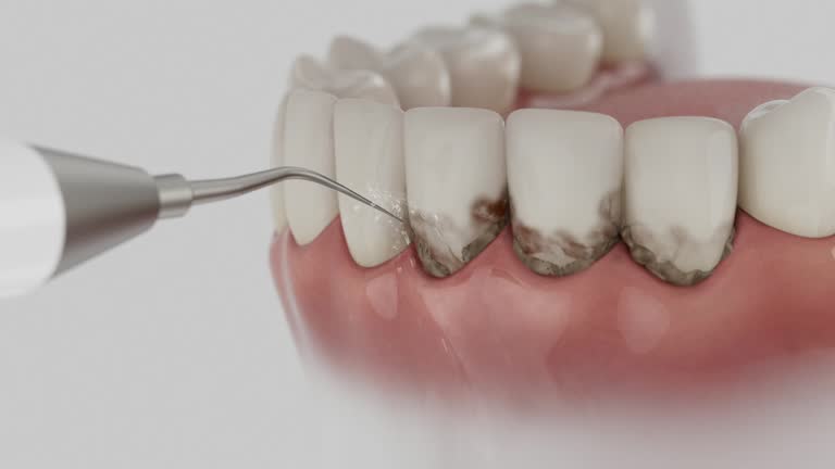 Trusted Dental Crowns And Bridges service in Eureka, MO - Dentist Open Now